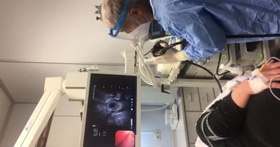 Endoskopik Ultrasonografi(EUS) ile safra yollarının değerlendirilmesi