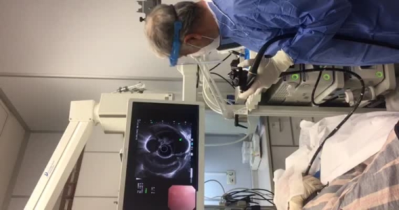 Endoskopik Ultrasonografi(EUS) ile mediastenin değerlendirilmesi